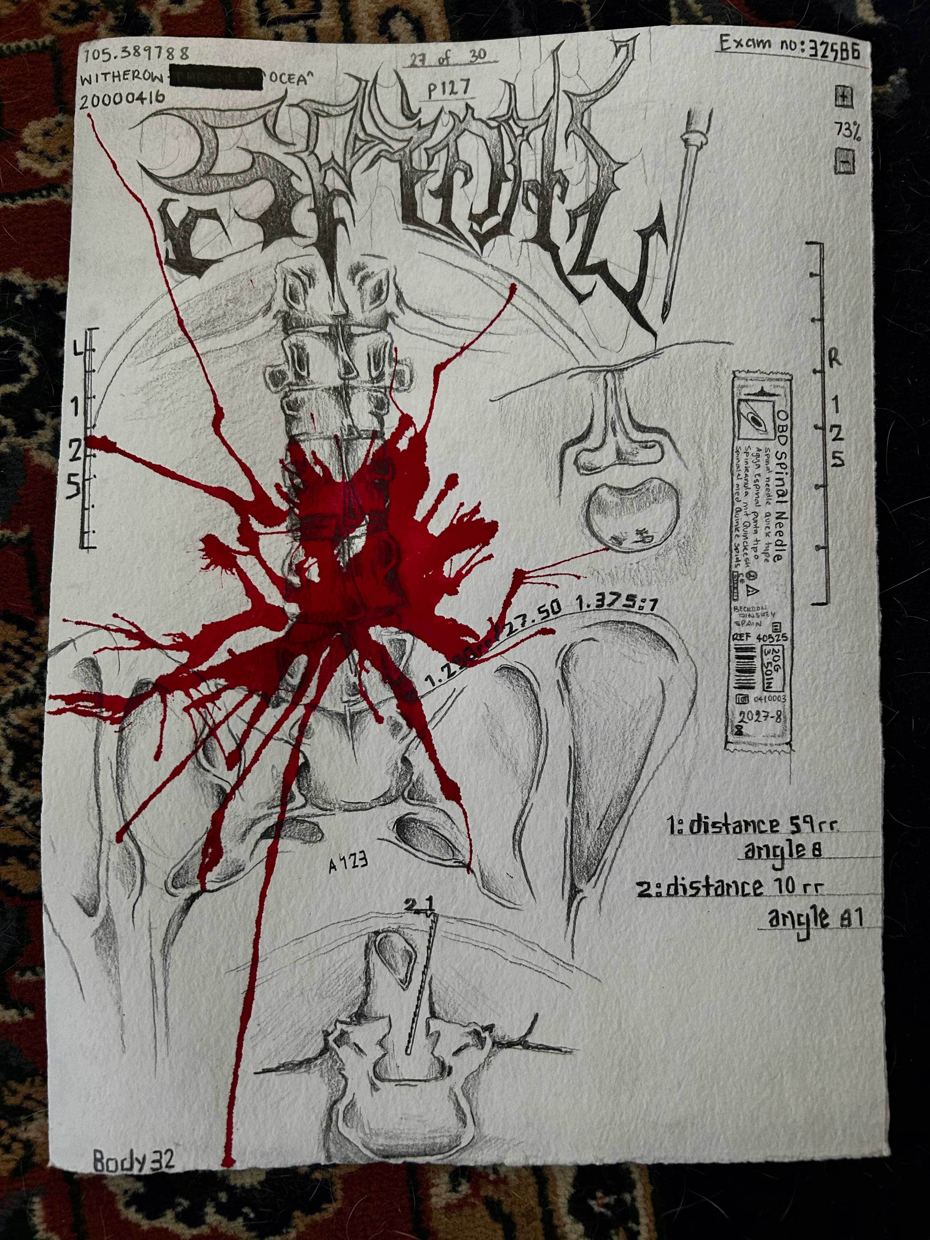 Spinal Puncture by Ocea Witherow
