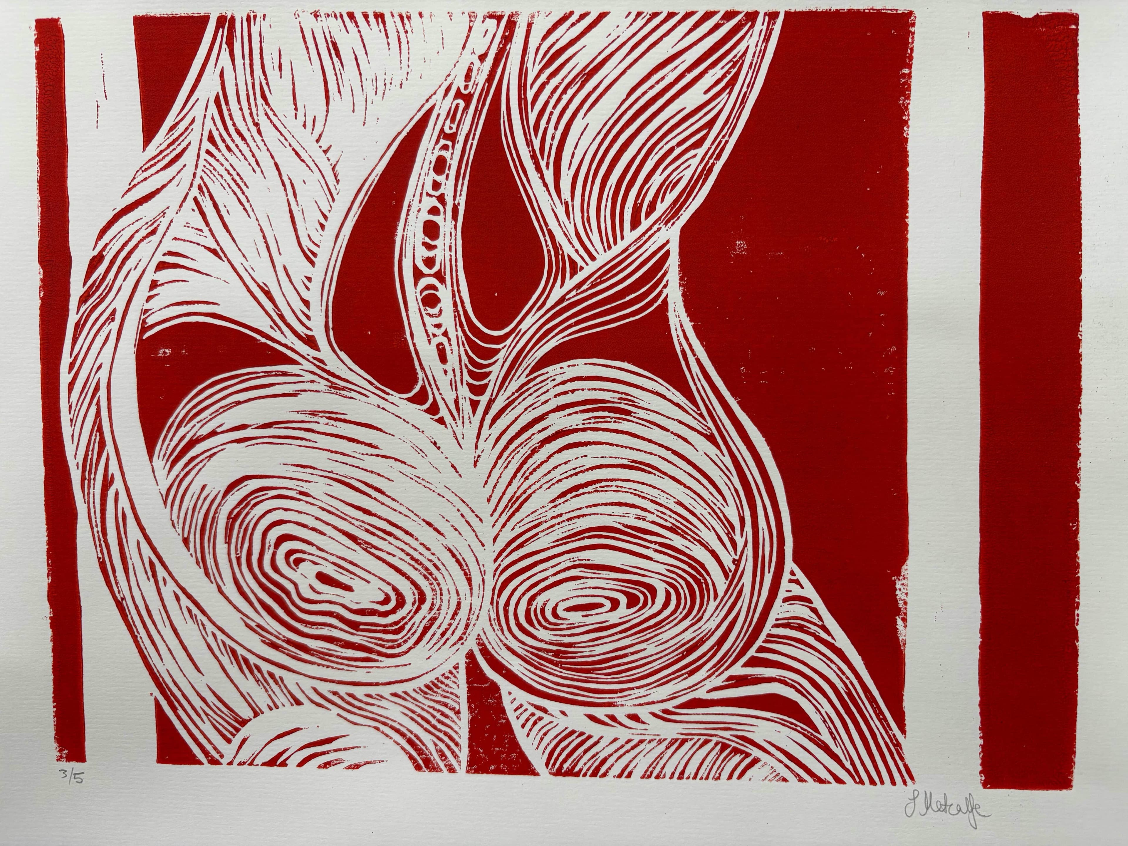 Back Pain by Suzanne Metcalfe