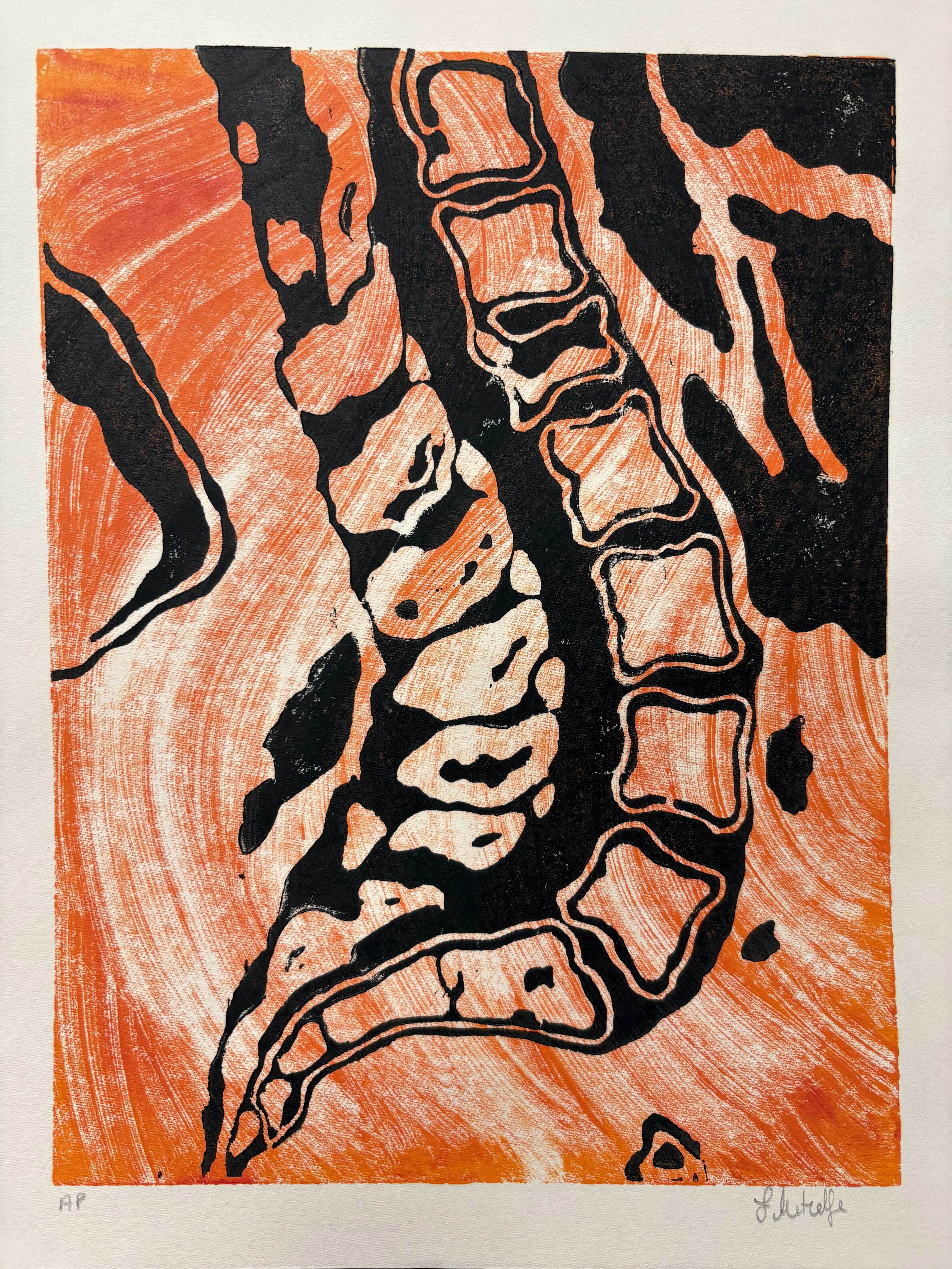 Spinal Tap by Suzanne Metcalfe