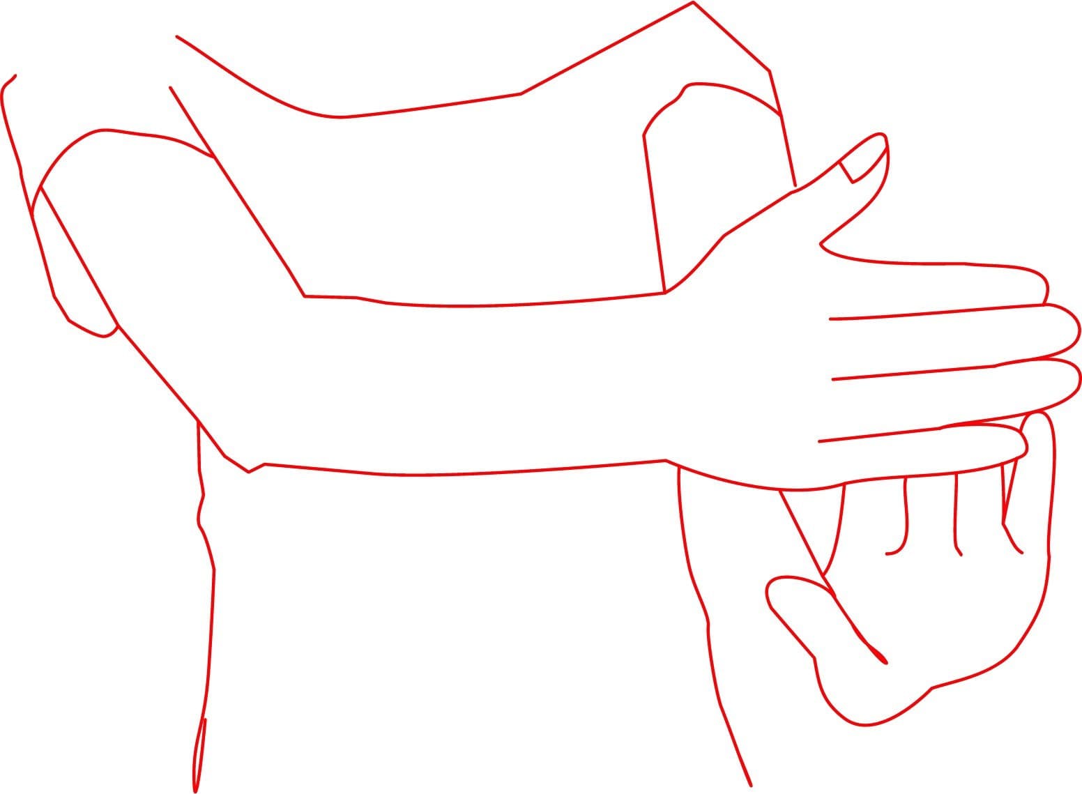 Spasticity illustration